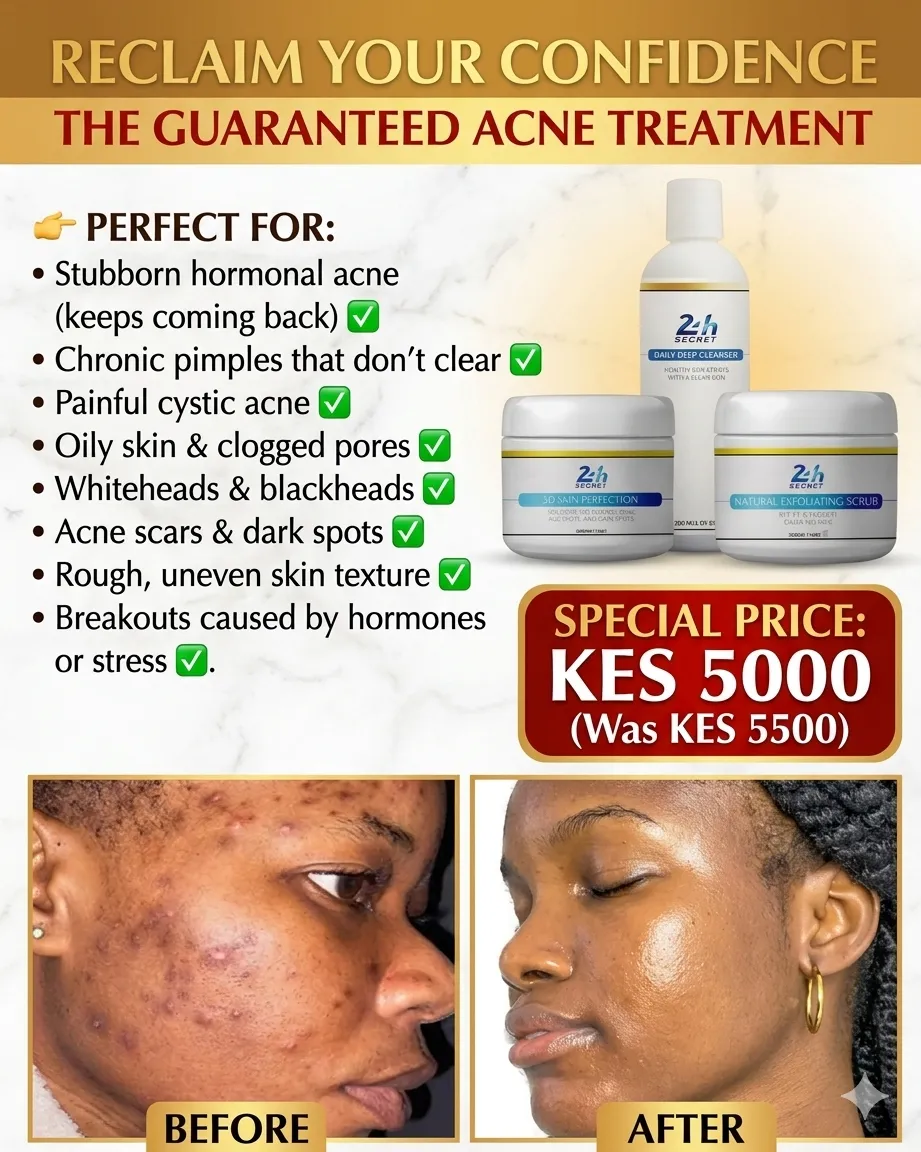 Acne Correction