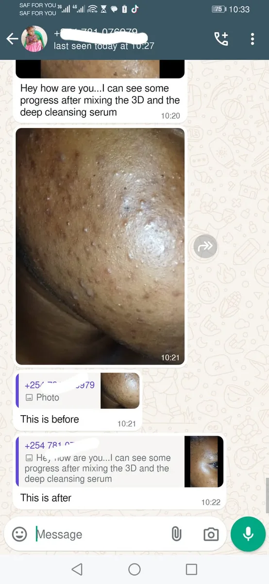 24HR SECRET client before &amp; after result, November 2024