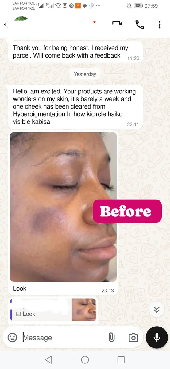 24HR SECRET client before &amp; after result, December 2024