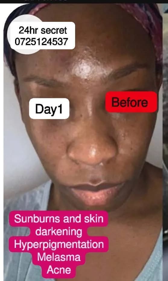 24HR SECRET client before &amp; after result, December 2024