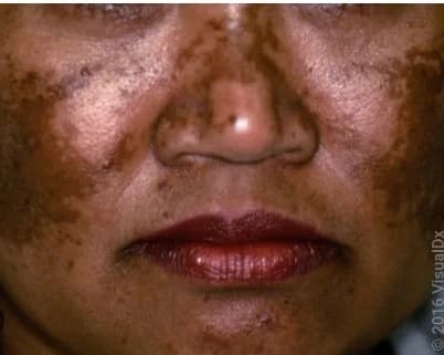 24HR SECRET client before &amp; after result, July 2025