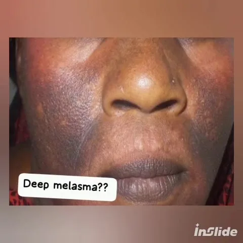 24HR SECRET client before &amp; after result, September 2025