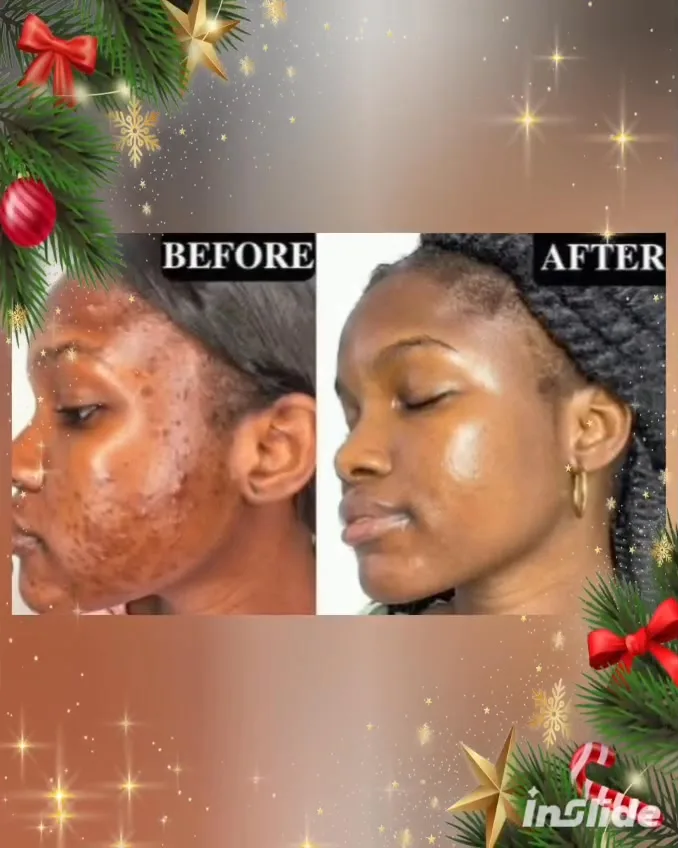 24HR SECRET client before &amp; after result, November 2025