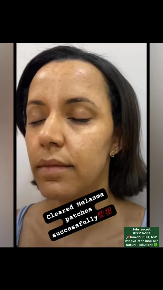 24HR SECRET client before &amp; after result, January 2026