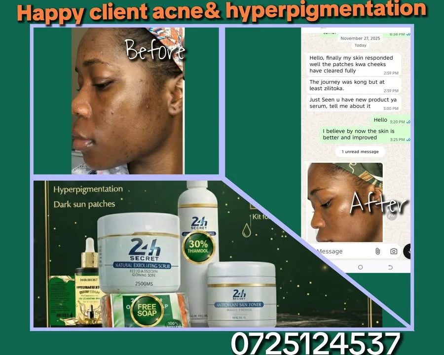 24HR SECRET client before &amp; after result, January 2026
