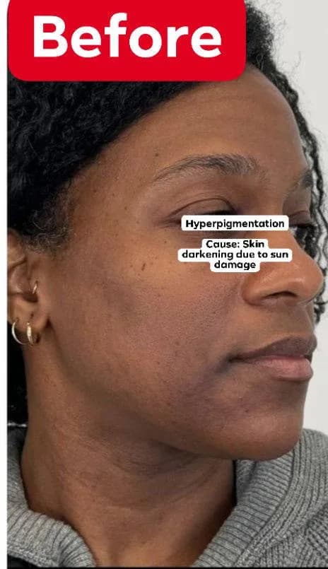 24HR SECRET client result — We mean REAL RESULTS Glowing skin.