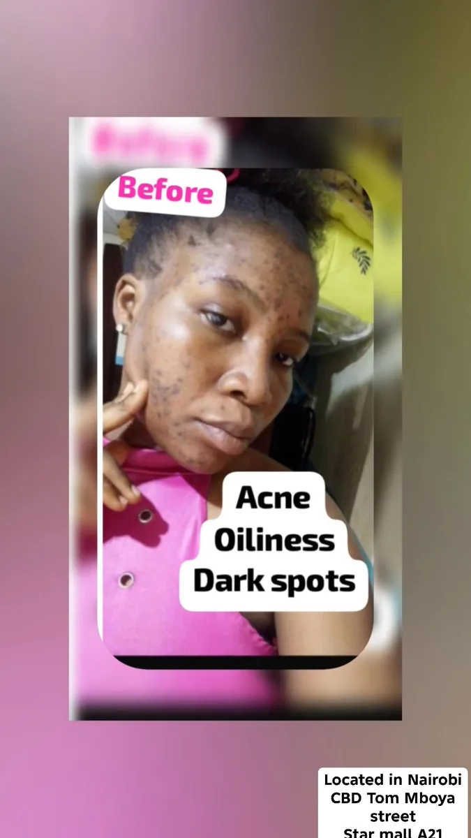24HR SECRET client before &amp; after result, May 2026