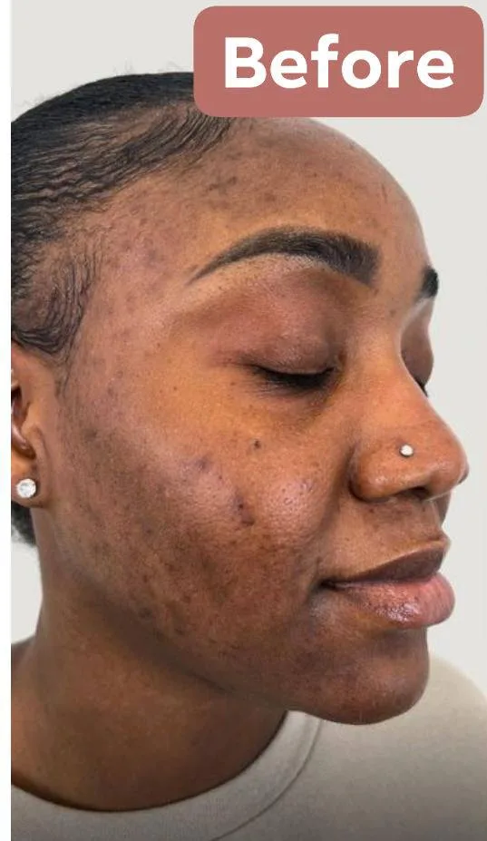 24HR SECRET client before &amp; after result, May 2026