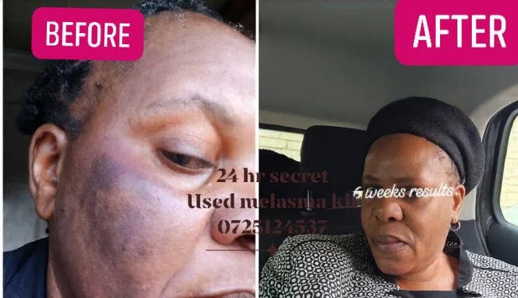 24HR SECRET client before &amp; after result, June 2026