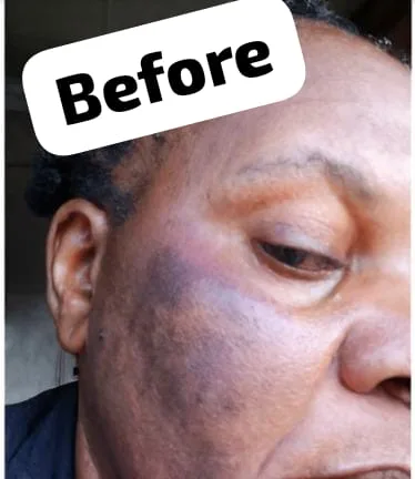 24HR SECRET client before &amp; after result, June 2026